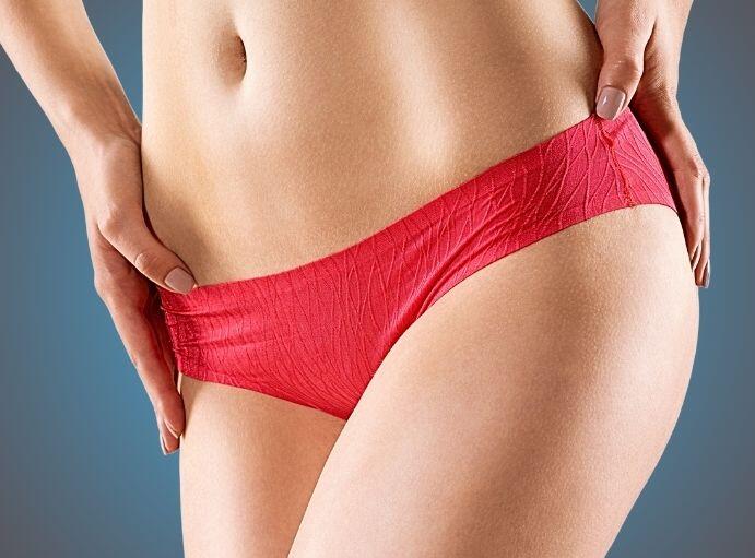 czerwone majtki kobiece - Labioplastyka – Jak długo się goi?