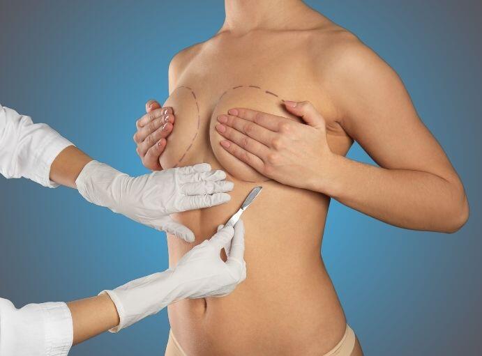 chirurg plastyczny pokazuje na pacjentce do powiększania piersi blizny